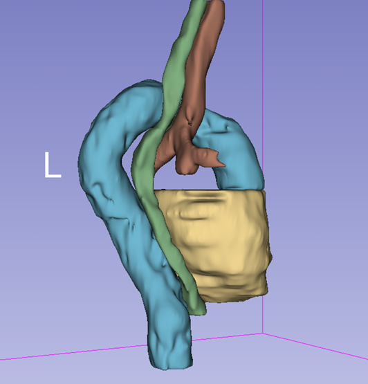 Improving 3D CT Organ Segmentation